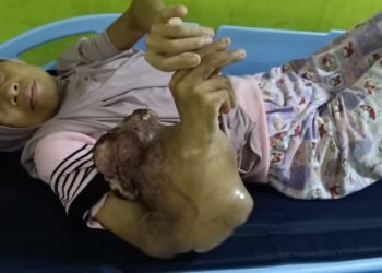 Mengidap Penyakit Kanker, Adawiyah Dievakuasi Babinsa Sungai Pinang