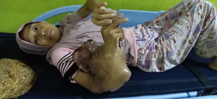 Mengidap Penyakit Kanker, Adawiyah Dievakuasi Babinsa Sungai Pinang