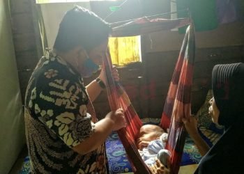 HM Rofiqi: Penderita Hidrosefalus, Lambannya Penanganan, Apalagi Kalau Menggunakan BPJS