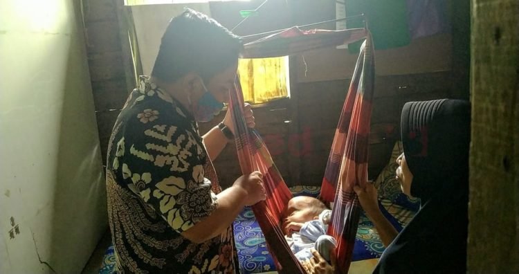 HM Rofiqi: Penderita Hidrosefalus, Lambannya Penanganan, Apalagi Kalau Menggunakan BPJS