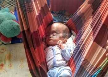 Diauddin: Kartu Jaminan Sosial Bayi Mengalami Tunggakan, Dan Tidak Memenuhi Syarat Untuk Operasi