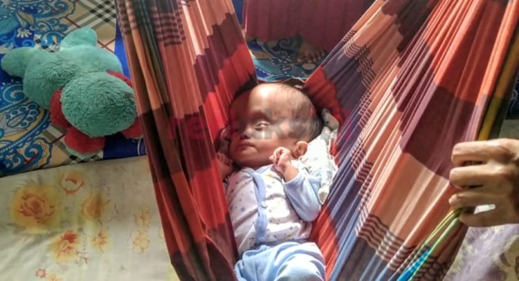 Diauddin: Kartu Jaminan Sosial Bayi Mengalami Tunggakan, Dan Tidak Memenuhi Syarat Untuk Operasi