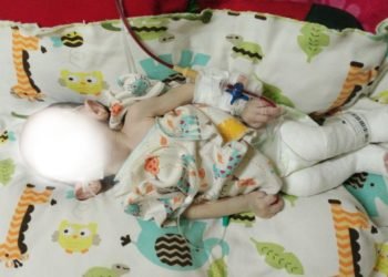 Tim Shalokal Ajak Dermawan Membantu Shilla Bayi 8 Bulan Penderita Hydrocephalus