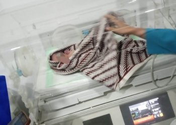 Lahir Prematur, Bayi Dibuang Alami Sesak Nafas