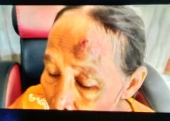 Oknom Polisi Diduga Aniaya ART Di Gambut