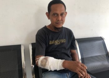 Monyet Ekor Panjang di Mentaos Agresif, Kulit Tangan Warga Robek 50 Jahitan