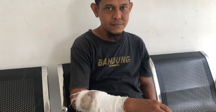 Monyet Ekor Panjang di Mentaos Agresif, Kulit Tangan Warga Robek 50 Jahitan