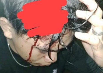 Driver Ojol Jadi Korban Penganiayaan di Minahasa Utara, Warga Minta Polisi Bertindak