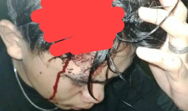 Driver Ojol Jadi Korban Penganiayaan di Minahasa Utara, Warga Minta Polisi Bertindak